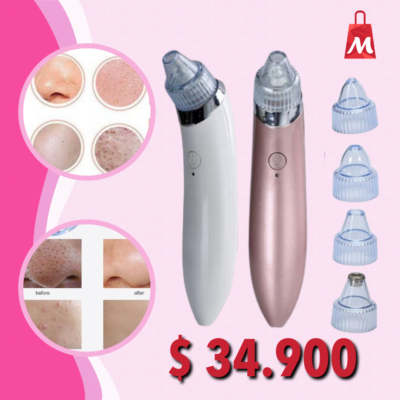 Extractor De Espinillas Y Puntos Negros